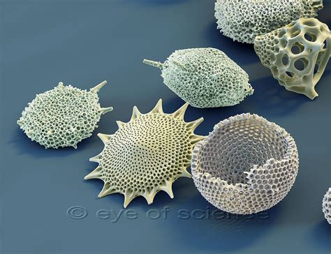  Radiolarians: Des Créatures Unicellulaires Avec une Architecture Intrigante qui Définissent la Beauté Microscopique!